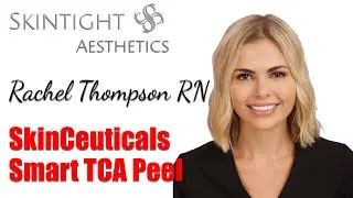 What is the SkinCeuticals Smart TCA Peel? And what does it do?