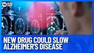 New Alzheimer's Drug Donanemab Could Drastically Slow Disease Progression