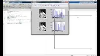 Histogram equalization and contrast stretching in Matlab