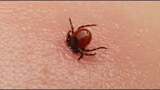 A pretty tick is crawling on my hand #tick #humour #funny #cute