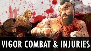 Мод для Skyrim: Vigor - Бои и травмы