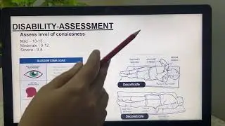 GLASSGOW COMA SCALE :- assess level of consciousness 