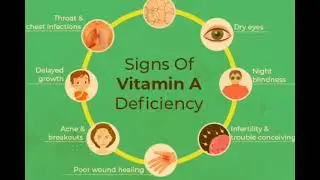विटामिन A Deficiency Symptoms causes and Treatment