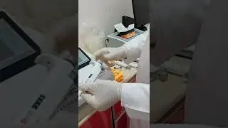 HBA1C BIOMED TURBI(عملي الكيرف)