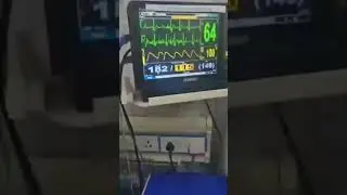 Hospital Patient Monitor/E.C.G., heart rate & SpO2 Live Display 