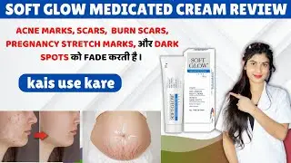 How is Soft Glow Cream? It cures all blemishes on the skin. How to use it? Side effects