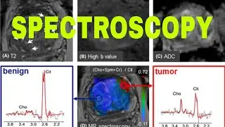 Mri Spectroscopy,How to read Mri Spectroscopy, Spectroscopy Filming Planing, Pathology