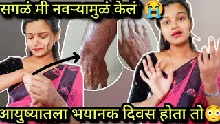 आठवल तरी रडायला येतंय😭पण का सगळेजण नवऱ्याला दोषी ठरवतात🥺तो फक्त एक एक्सीडेंट होता🥺न विसरणारा तो दिवस