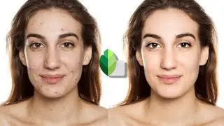 REMOVE PIMPLES on your photo || Healing Tools in Snapseed