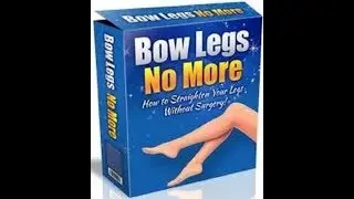 Bow Legs No More