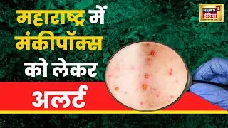 Monkeypox Virus: दुनियाभर में मंकीपॉक्स का कहर, क्या है इसके लक्षण? Hindi Latest News
