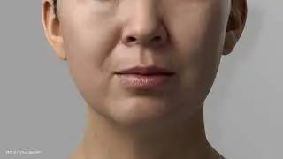 The Science of Skin Aging & Collagen: How Sculptra&reg; Revitalizes from Within | Barry M. Weintraub MD