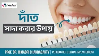 দাঁত সাদা করার উপায় | Teeth Whitening: How It Works? - Explained by Dr. Himadri Chakrabarty