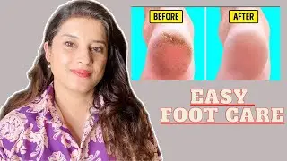 5 Ways to Take Care of Your Feet |Crack-free feet ft. Vilvah's Foot Cream