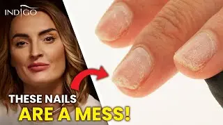 These NAILS are a MESS! &ndash; a repair of a damaged nail step by step | Indigo Nails