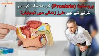 Prostate Ki Alamat Ko Door Karne Ke Liye Tarze Zindagi Main Tabdeeliyan! In urdu!