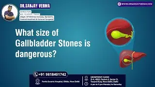 Gallbladder Explained: Symptoms, Causes, and Best Treatment Options | Dr. Sanjay Verma