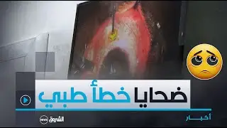 #سوق_أهراس| تعقيــدات صحيــة خطيـــرة لمرضــى أجــــروا عمليــــات جراحيـــة بعيـــادة خاصـــة 🥲😱👇