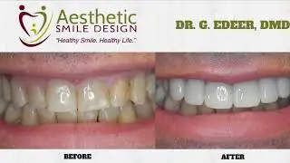 Transform Your Smile: Cosmetic Dentistry & Invisalign | Aesthetic Smile Design, NJ