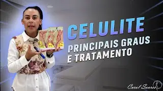 CELULITE - Aula Completa (Sem complicação)