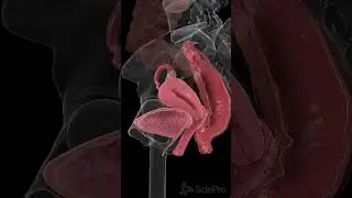 Endometriosis: Beyond the Uterus