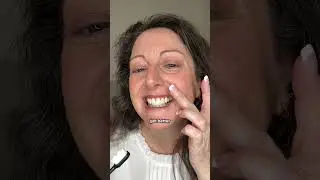 My results after using Red Light Therapy For my Gums... You can't believe the results! 🔴