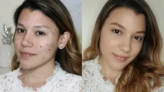 No Makeup Makeup Look For Acne I msuazo