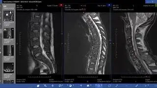 Spine Labeling