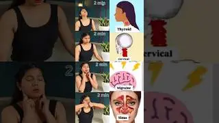 Practice this in Thyroid, Cervical, Migraine and Sinus| Save & Share #Yoga #shorts #shortsfeed