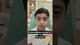 Child Squint surgery #visioncarehospital