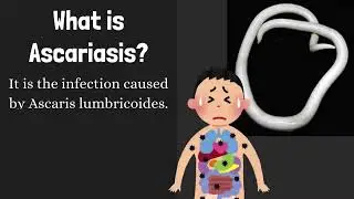 Ascariasis (Roundworm Infection)