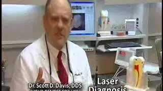 Spokane Dentist Dr. Davis DDS Laser Diagnosis Spokane Dentist