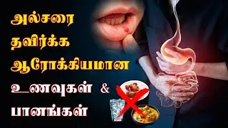 அல்சரை தவிர்க்க ஆரோக்கியமான | Avoid Ulcer with Healthy Food & Drinks | Food Tips #viral #trending