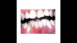 2 hollis x kidszn experimental type beat // jawbreaker*