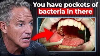 The Hidden Infection in Your Mouth That Can Lead To Memory Loss