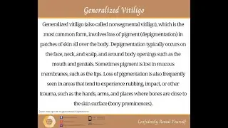 Generalized (Nonsegmental) Vitiligo