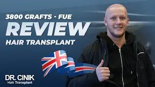 Dr.Cinik Hair Transplant | FUE Sapphire | 3800 Grafts | Nathan Martin Review