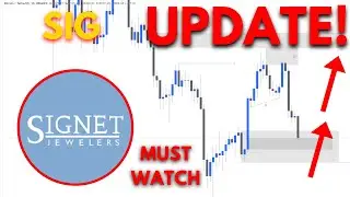 🔥 SIG Stock (Signet Jewelers Stock) SIG STOCK PREDICTIONS! SIG STOCK Analysis! STOCK! SIG Today