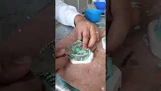 cast Duplication #shorts #youtubeshorts #short #viral #viralvideo #viralshorts #dentistry #trending
