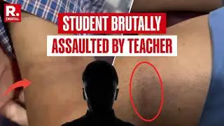 Bengaluru: Class 4 Student Brutally Assaulted By Teacher For Not Doing Homework, FIR Filed