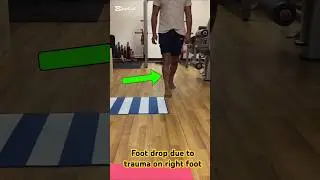 Foot Drop 🦶🏽 Exercise #youtubeshorts #ytshorts