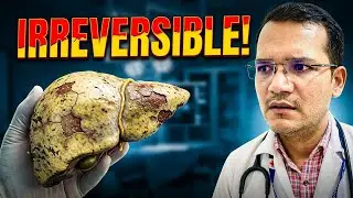 Alcoholic Liver Disease: Early Signs Before It's Too Late आपका लिवर फ़ैल होने वाला है