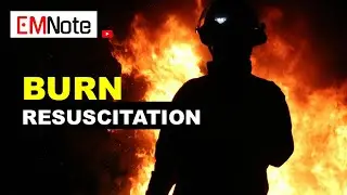 Fluid Resuscitation in Burn Patients