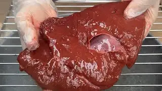 Um truque genial para o f&iacute;gado que ningu&eacute;m conhece!