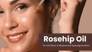 Rosehip Oil for Dark Spots in Melasma and Hyperpigmentation #rosehipoil #skincare