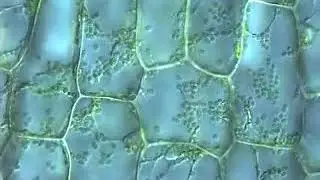 Elodea Leaf Cells