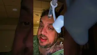 Waking up after amputation