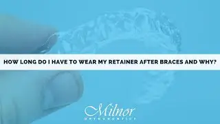 How Long Do I Have to Wear My Retainer after Braces and Why