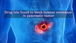 Drug trio found to block tumour resistance in pancreatic cancer
