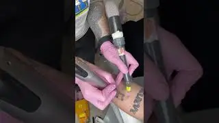 Лазерное удаление тату ✔️ #tattooremove #tattoo #лазерноеудалениетату